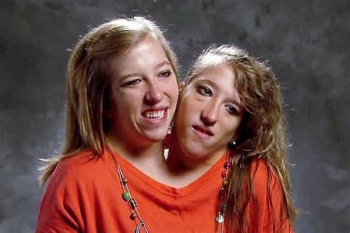Conjoined Twins Abby and Brittany Hensel: Now Teachers