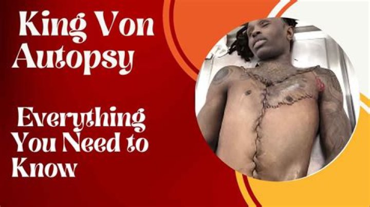 King Von's Cause of Death: Autopsy Report & Details