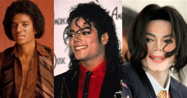 Michael Jackson's Vitiligo Journey: Truth & Transformation